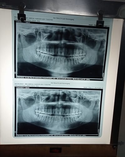 x-ray view box - medical product